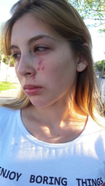 Patota de hombres y mujeres golpearon y robaron a una joven