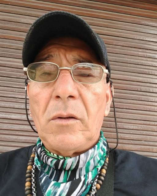 Campaña solidaria para  ayudar a 'Piero' en una  costosa cirugía ocular