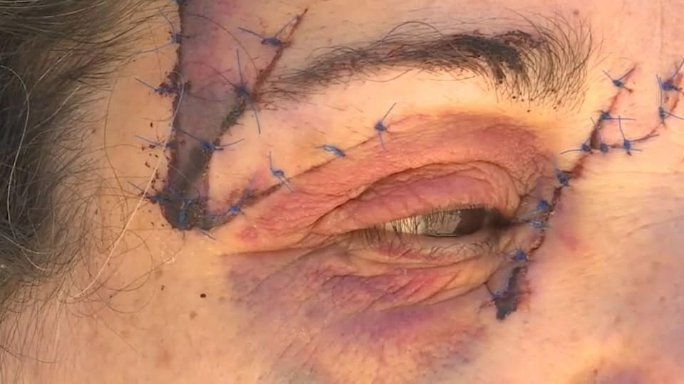 Una mujer fue ataca a golpes  y luego recibió dos puñaladas