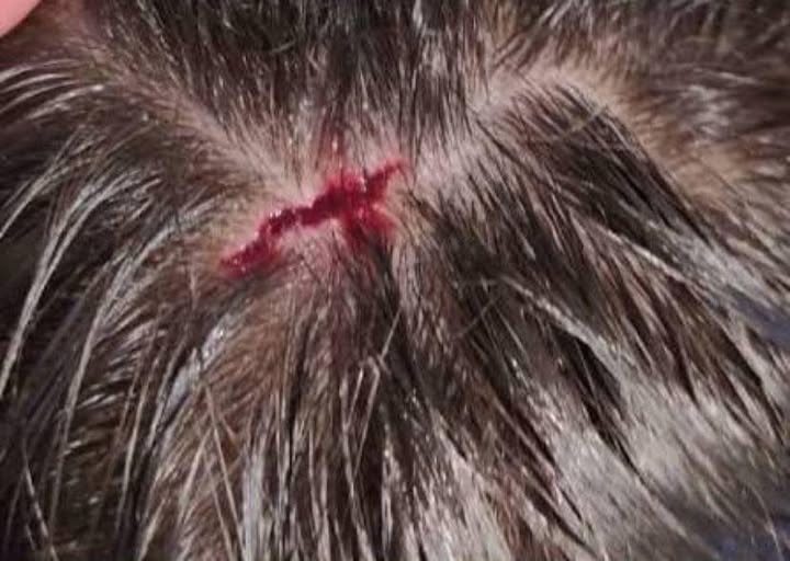 Un curioso ataque de un ave sorprendió a un adolescente en Plaza 25 de Mayo