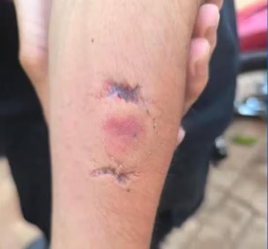 Conflicto familiar terminó  con una efectivo policial  mordida por una menor