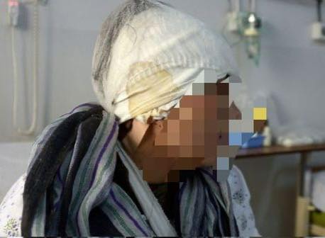 Violenta pelea vecinal: le abrió la cabeza con un hierro en la madrugada