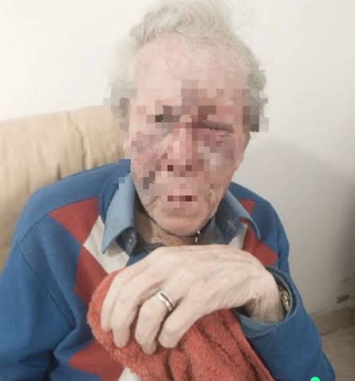 Noche de terror para una pareja de jubilados: fue golpeada por su hijo